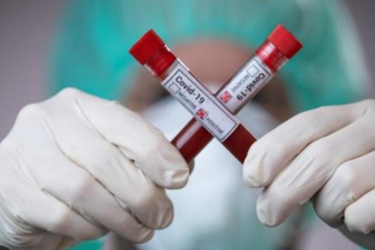 В Одесі продовжує знижуватися захворюваність на COVID-19