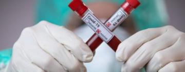 В Одесі продовжує знижуватися захворюваність на COVID-19