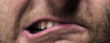 Правоохоронець в лікарні: на Одещині п’яний іноземець влаштував скандал в сільраді і укусив поліцейського за ногу 