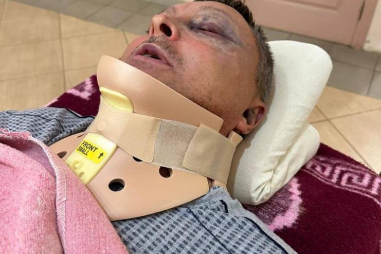 На Одещині побили та пограбували військового
