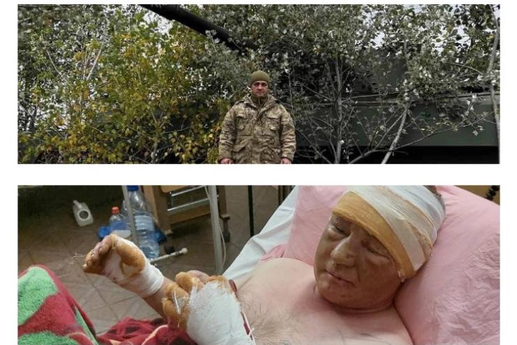 Захисник з Павлівської громади потребує вашої допомоги. Долучайтеся!