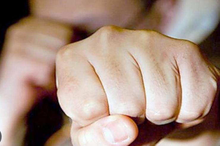 Підліток заступився за жінку та отримав черепно-мозкову травму