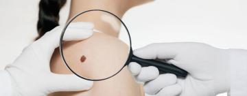 Науковці почали випробування на людях індивідуальної вакцини від раку шкіри