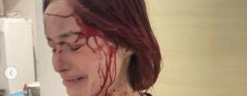 Жертва чи провокатор? Одеситка, яка стверджує, що її побив військовий, з заявою до поліції не зверталась