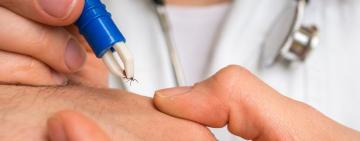 На Одещині зареєстровано випадок  захворювання на кліщовий вірусний енцефаліт