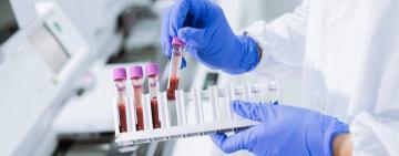 Зростання захворюваності на кишкові інфекції на Одещині: уражені діти та дорослі