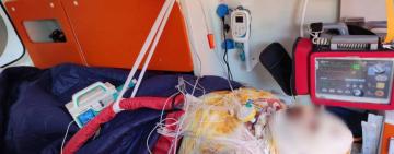 9 годин на межі: як команда Центру ЕМД Одещини забезпечила успішне транспортування пацієнта з важкими травмами