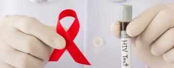 Одещина має найвищий рівень захворюваності на СНІД в Україні, а також лідирує за смертністю, – МОЗ