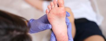 На Одещині зафіксовано випадки кору у матері та невакцинованої дитини: що потрібно знати про хворобу та захист