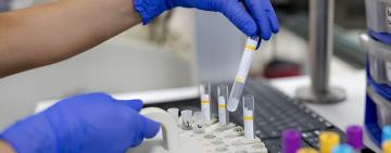 ЕПІДЕМІЧНА СИТУАЦІЯ В ОДЕСЬКІЙ ОБЛАСТІ. Сезонний сплеск чи контрольована ситуація? 