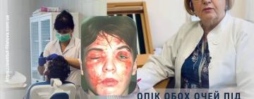 В Інституті Філатова відновили зір підлітку після вибуху петарди