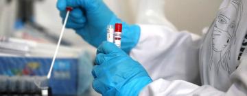 Ботулізм та хвороба Лайма: в Одеській області фіксують небезпечні випадки, епідемситуація загалом контрольована