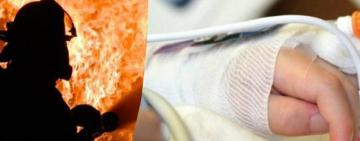 Пожежа в багатоквартирному будинку в Кілії: чоловік у тяжкому стані госпіталізований