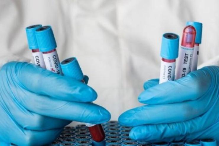 В Україні зафіксували перший випадок субваріанту COVID-19 «Цикада» — МОЗ