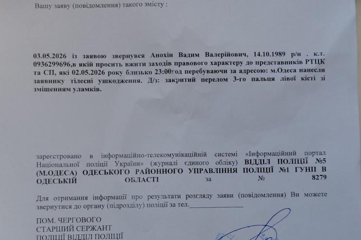 ТЦК жорстко побили та зламали руку актору Одеського академічного драматичного театру