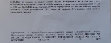 ТЦК жорстко побили та зламали руку актору Одеського академічного драматичного театру