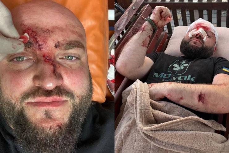Побиття ветерана АТО через російську музику в Затоці: поліція відкрила справу, нападником виявився житель Подільська